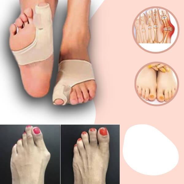 Orthèses pour hallux valgus